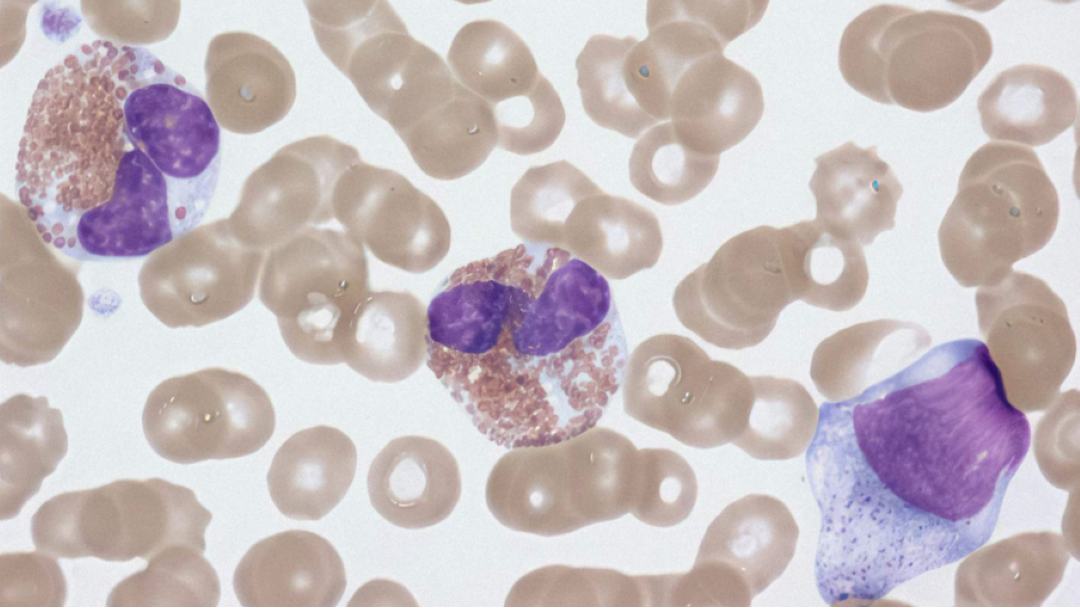 Blodceller hematologi i fargene lyse brun og lilla.